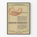 Poster vintage Le pansement gastrique Bismuth Desleaux