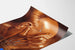 Poster vintage Trisodyl Ipertensione Sclerosi arteriosa